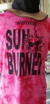 SUN　BURNED